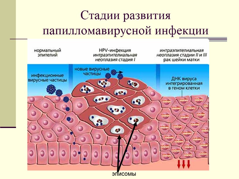 Стадии развития папилломавирусной инфекции  эписомы